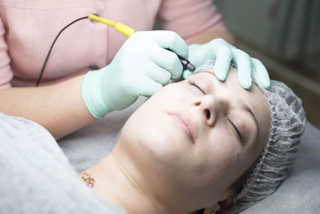 Electrolysis hair removal
